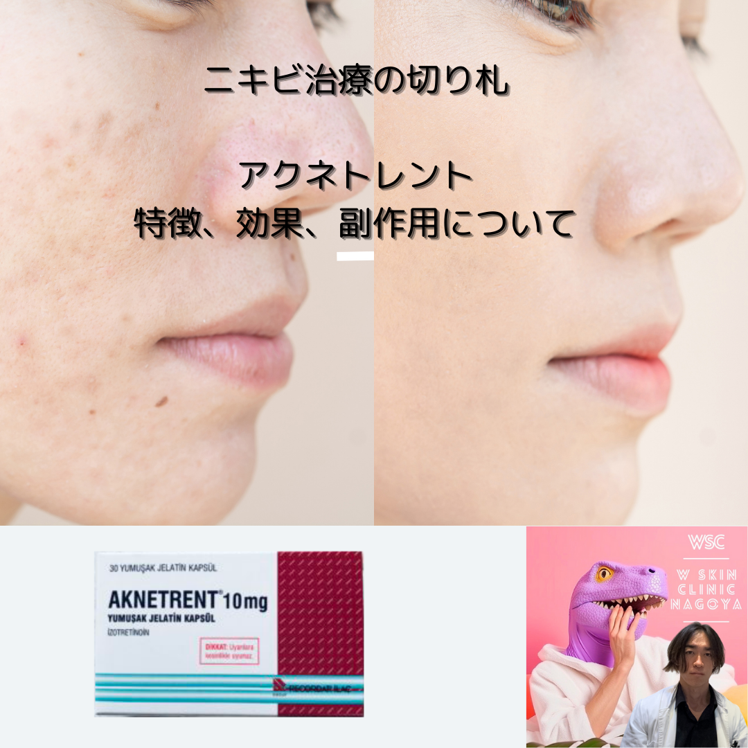 アクネトレントの特徴、用法用量、投与期間、効果について、名古屋の美容皮膚科医が解説