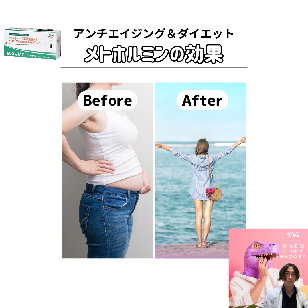 メトホルミンのアンチエイジング効果とダイエット効果の特徴、メカニズムについて、名古屋の美容皮膚科医が解説