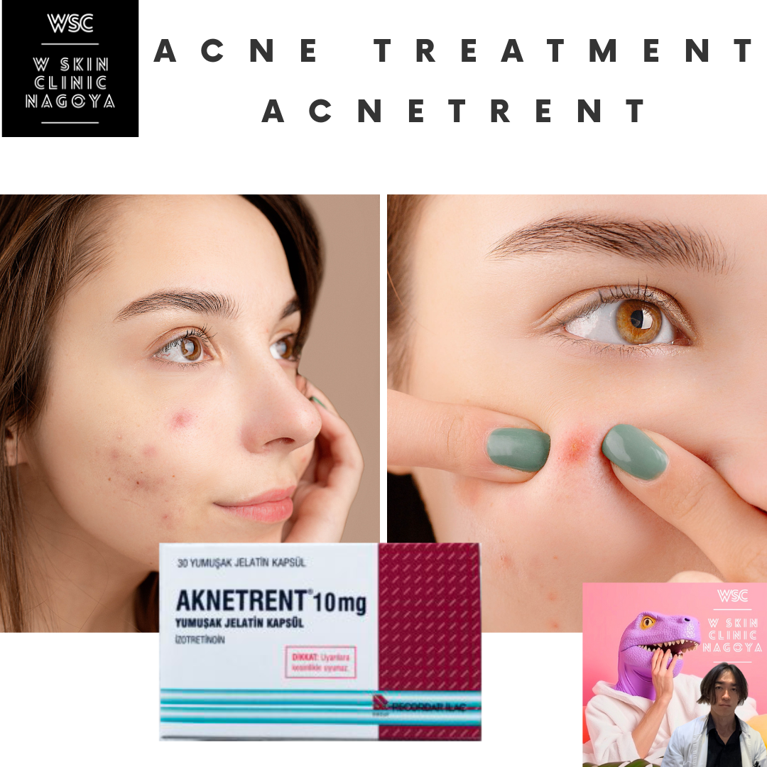 Is Acnetrent(Isotretinoin) the Ultimate Solution for Acne Treatment?